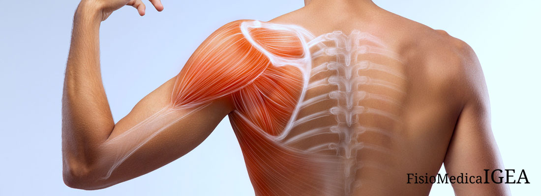 La borsite alla spalla, conosciuta anche come borsite subacromiale o borsite subdeltoidea, è una delle più comuni cause di dolore nella parte anteriore e superiore della spalla.