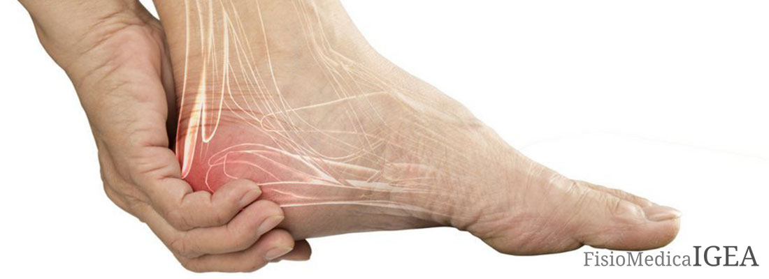 Tallonite è un'infiammazione che colpisce la parte posteriore del piede, più precisamente la zona del tallone.