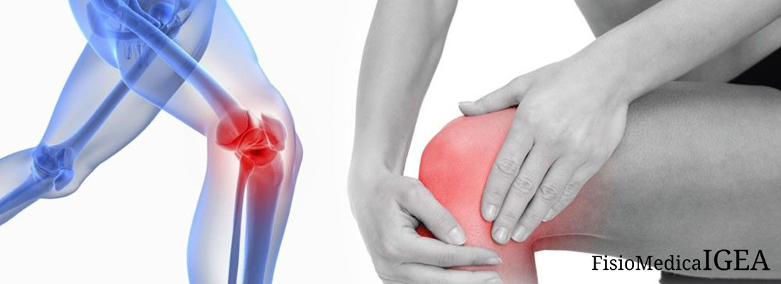 Tendinopatia rotulea, conosciuta anche come “Jumper’s knee” o ginocchio del saltatore, è una condizione patologica di tipo infiammatorio acuto o cronica che interessa la porzione prossimale del tendine rotuleo.