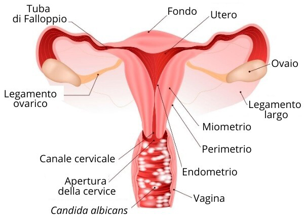 Candida Vaginale Centro FisioMedica IGEA 