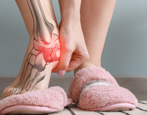 Malattia di Sever Diagnosi e Trattamento, Visita Ortopedica. Centro di Fisioterapia FisioMedica IGEA di Roma, zona Centocelle, Prenestino.