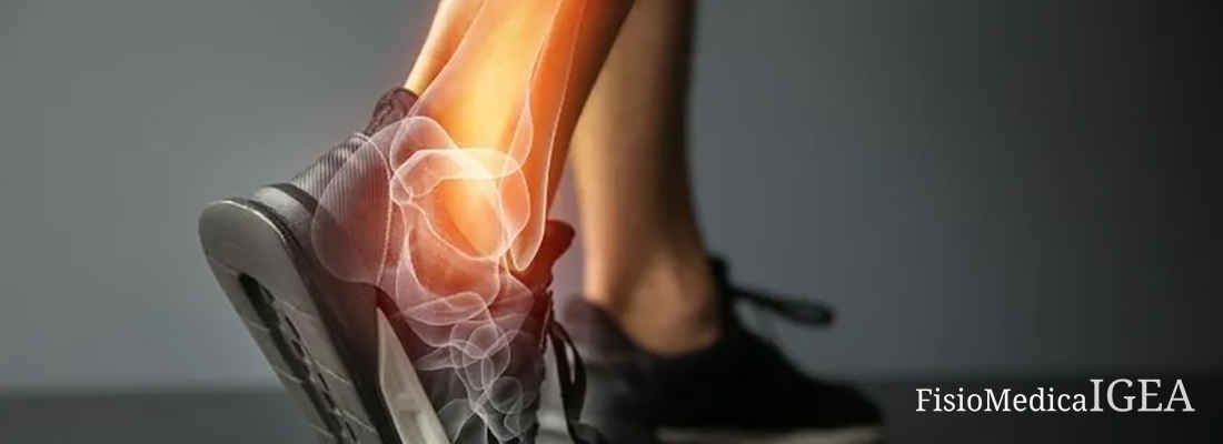 Distorsione della Caviglia: Come Recuperare e Prevenire Recidive.