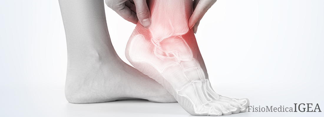 Fisioterapia Caviglia a Centocelle Roma. Centro FisioMedica IGEA.