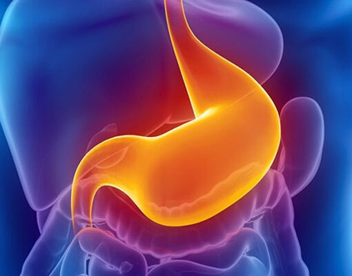 Reflusso gastroesofageo: sintomi, cure e cosa mangiare.