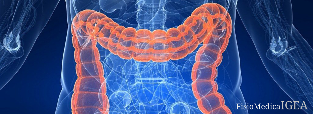 Colon irritabile: sintomi, stress e alimentazione.